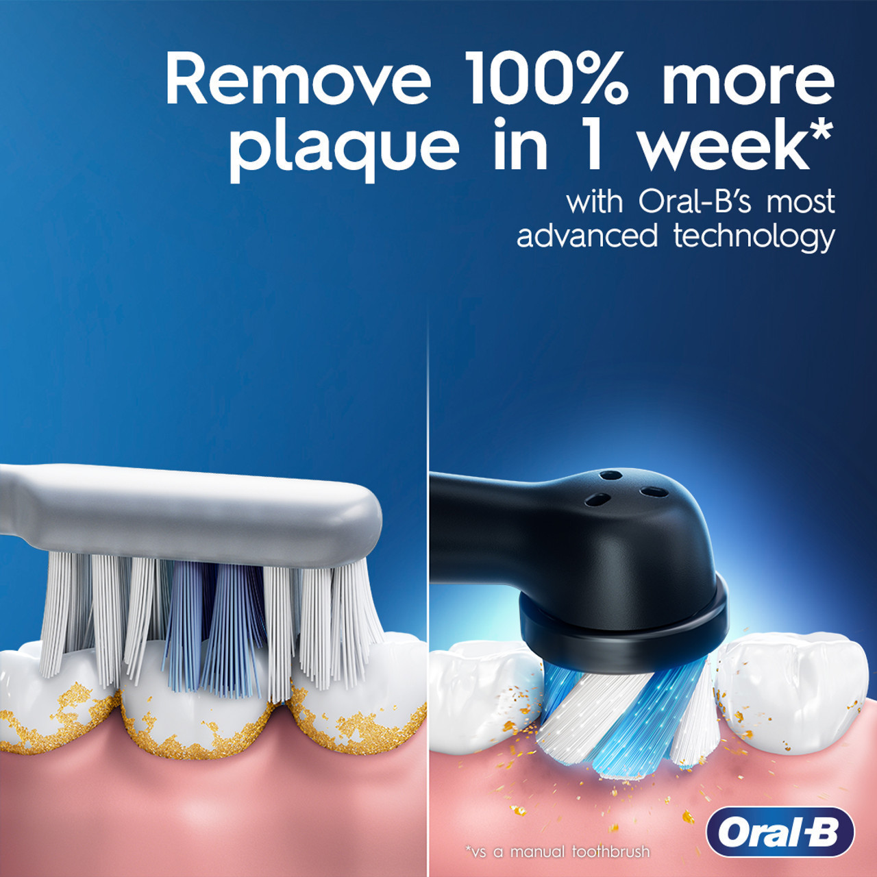 Oral-B + Crest iO Series 4 Gum Care Bundle, Black - Image 3