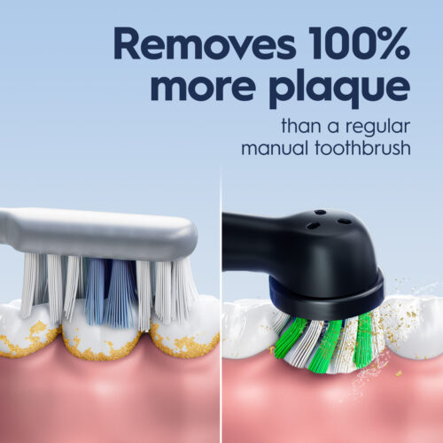 Alternative view of Pro 1000 Rechargeable Electric Toothbrush, Black