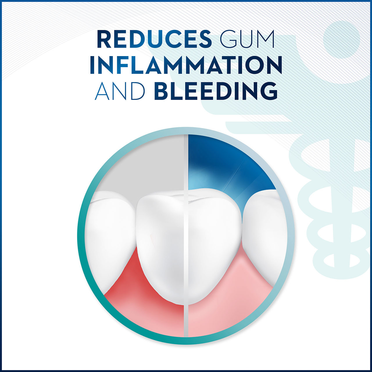 Gum Detoxify Mouthwash Special Care Oral Rinse - Image 5